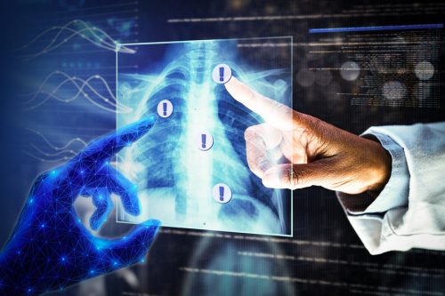 AI mới giúp phát hiện vùng bất định trong chẩn đoán hình ảnh